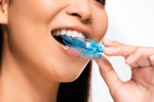 Invisalign kennewick, wa